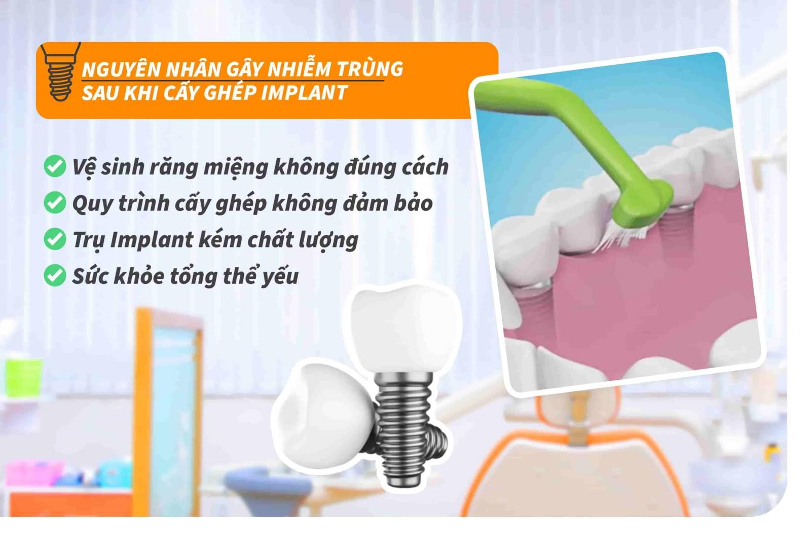 Nguyên nhân gây nhiễm trùng Implant sau khi cấy ghép