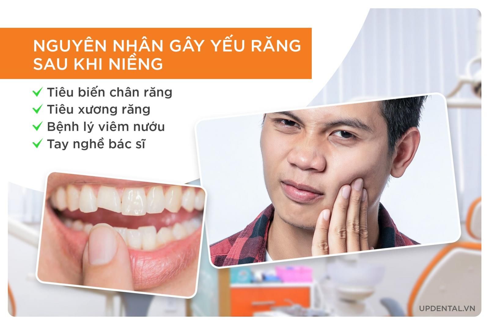 nguyên nhân làm răng yếu khi niềng