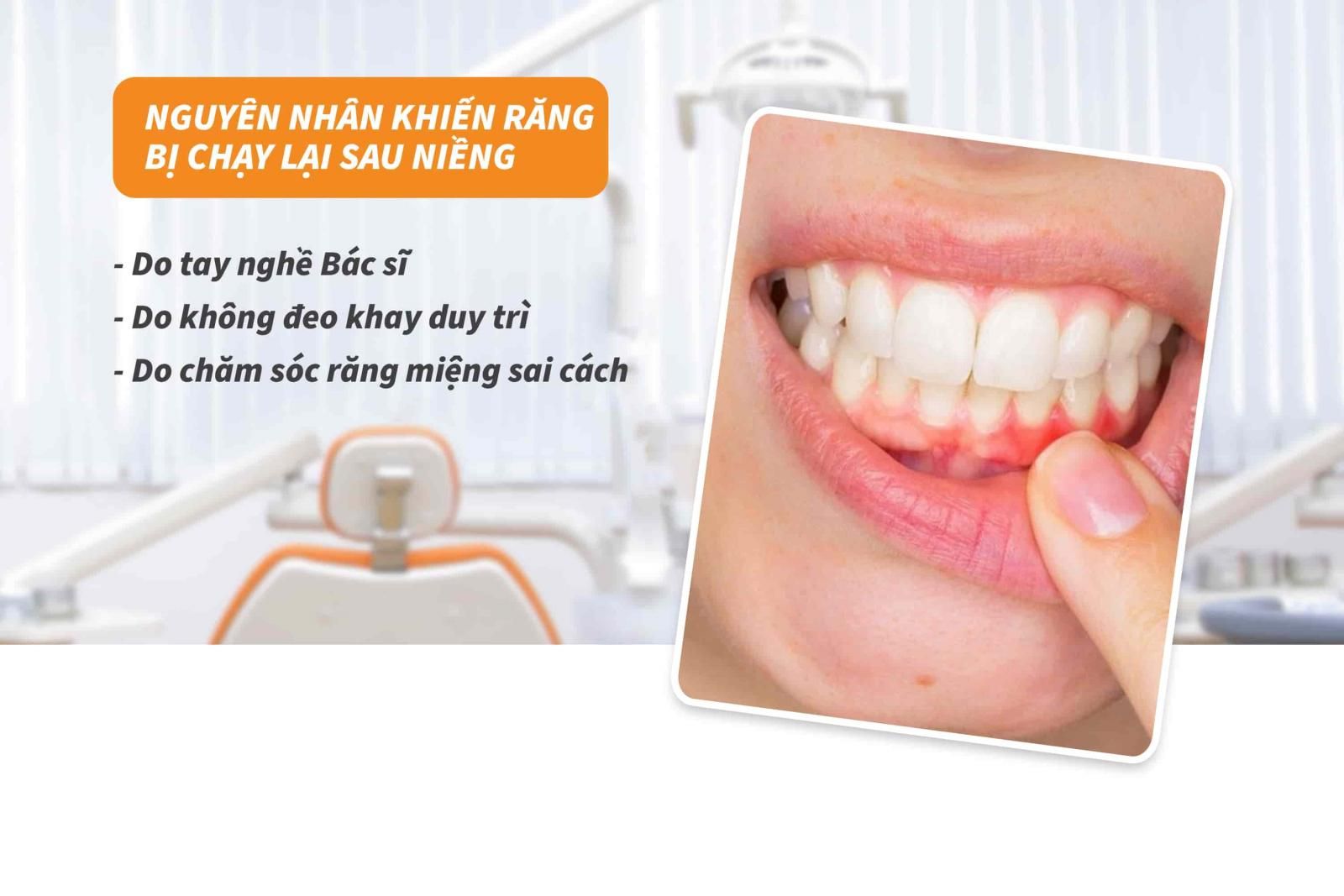 Nguyên nhân khiến răng bị chạy lại sau niềng