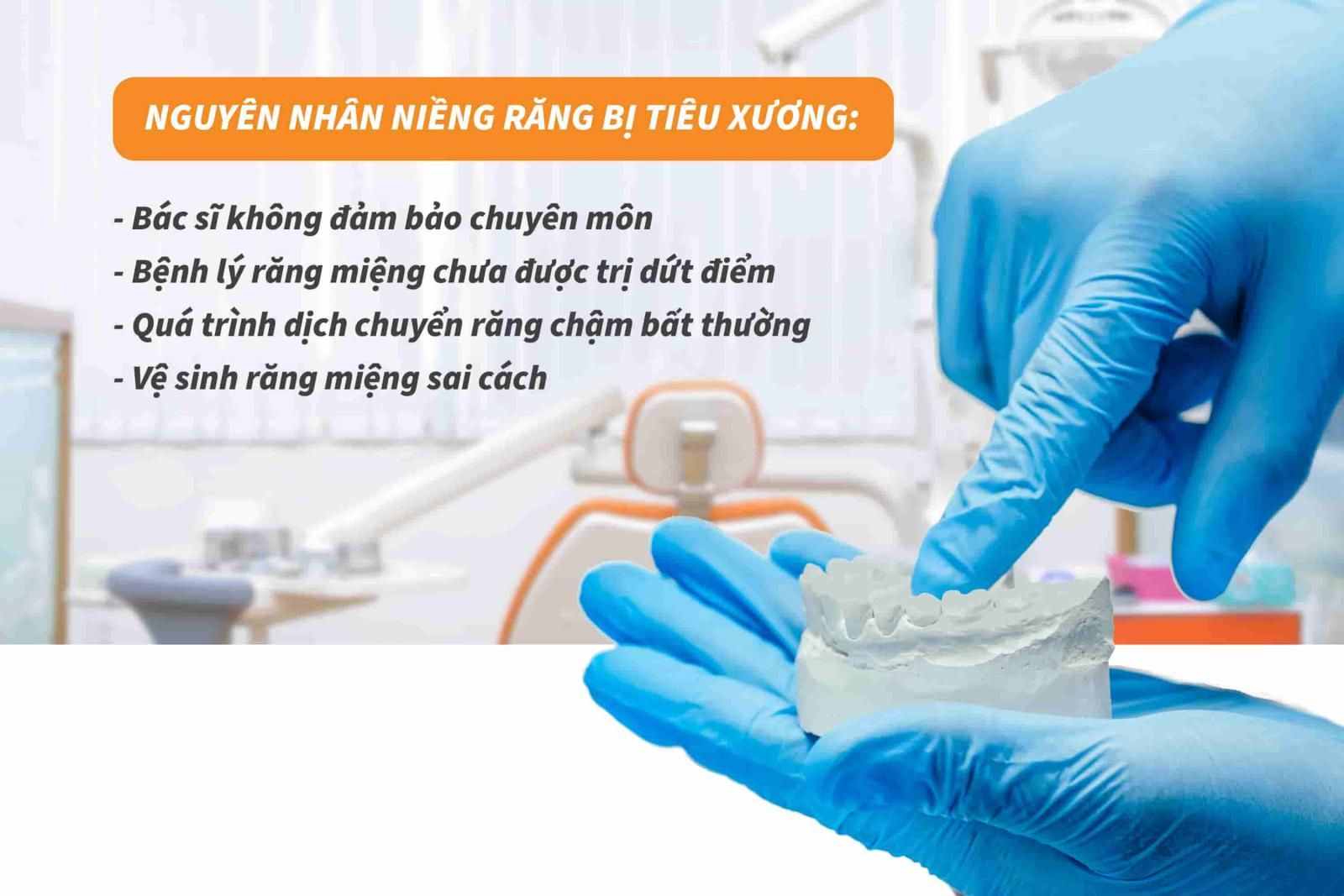 Nguyên nhân niềng răng bị tiêu xương 