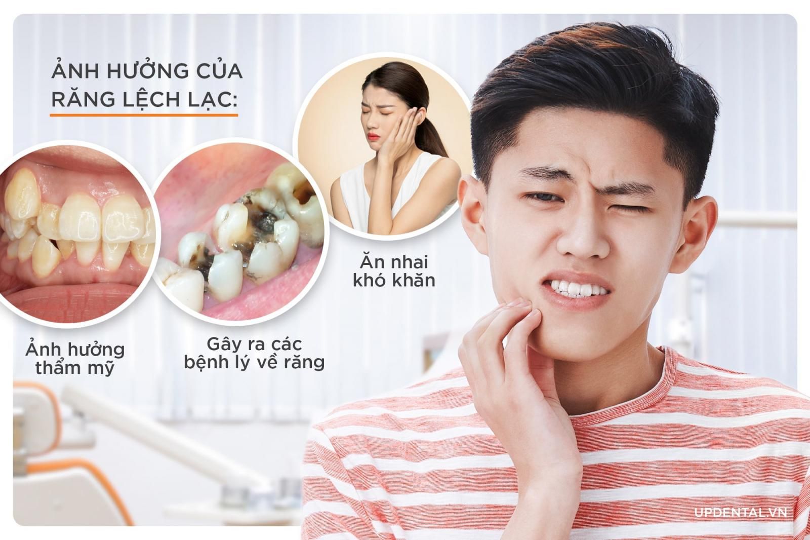 nguyên nhân khiến răng lệch lạc