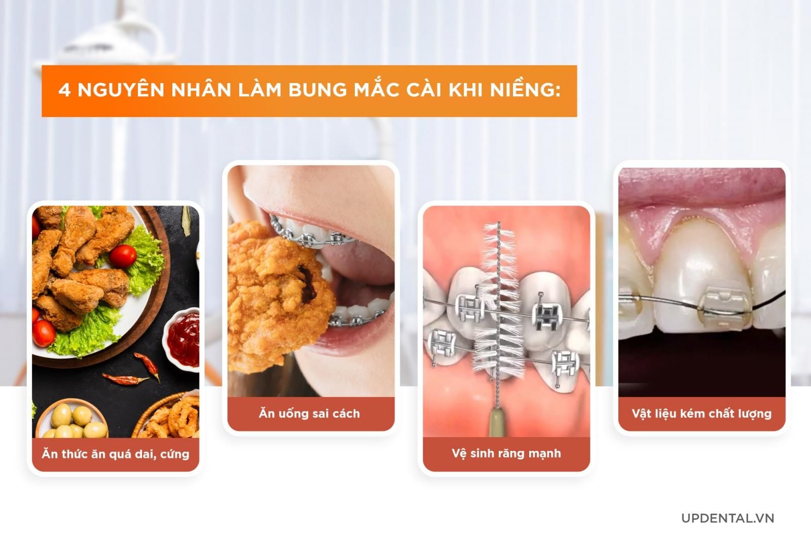 nguyên nhân niềng răng bị bung mắc cài