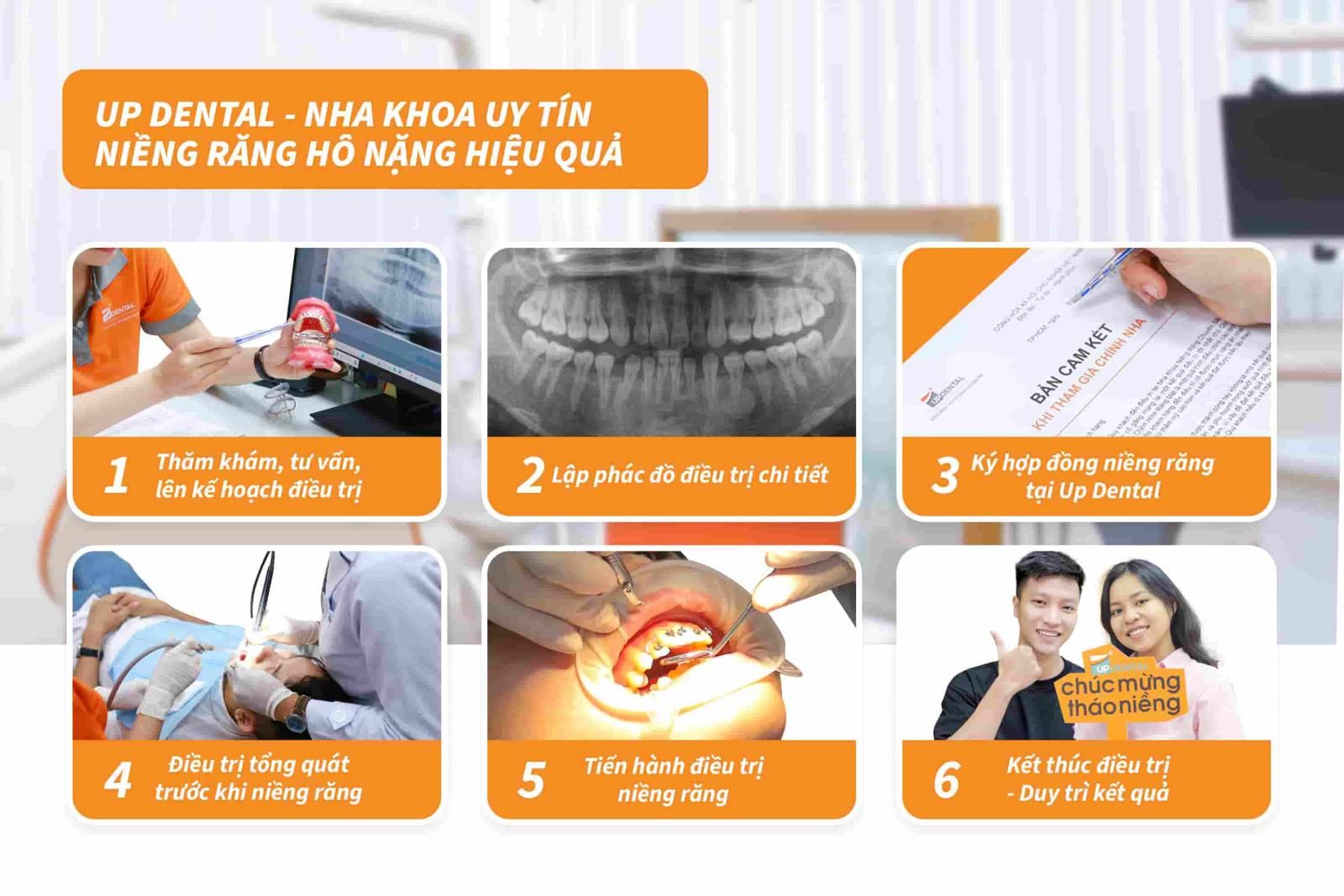 Up Dental - Nha khoa uy tín niềng răng hô nặng hiệu quả