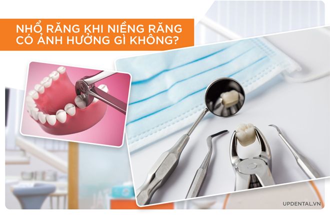 nhổ răng có ảnh hưởng gì không?