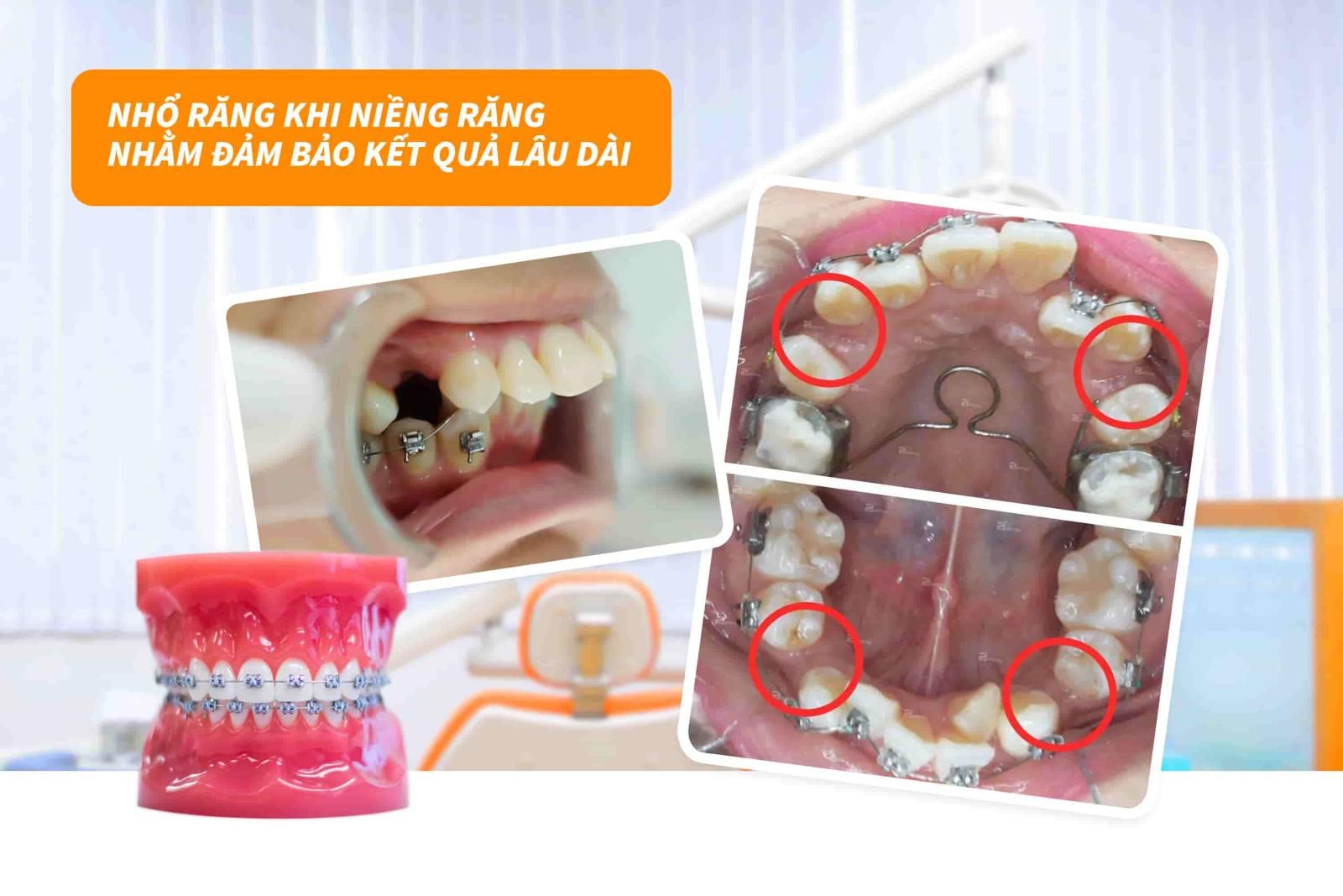 Đảm bảo kết quả lâu dài