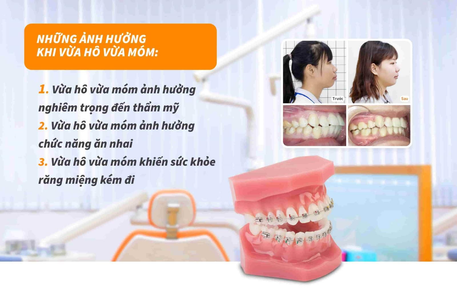 Những ảnh hưởng khi vừa hô vừa móm