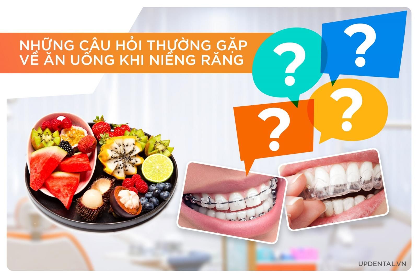 Những câu hỏi thường gặp khi niềng răng