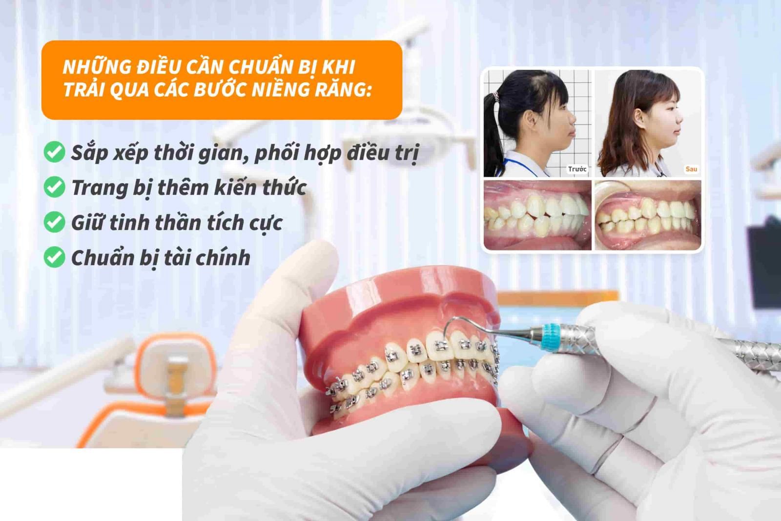 Những điều cần chuẩn bị khi trải qua các bước niềng răng