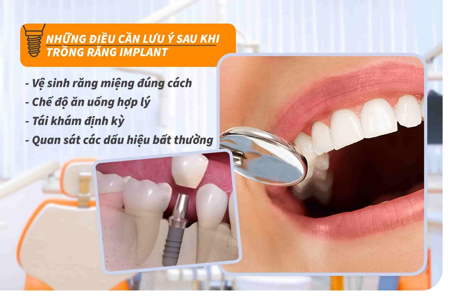 Những điều cần lưu ý sau khi trồng răng Implant