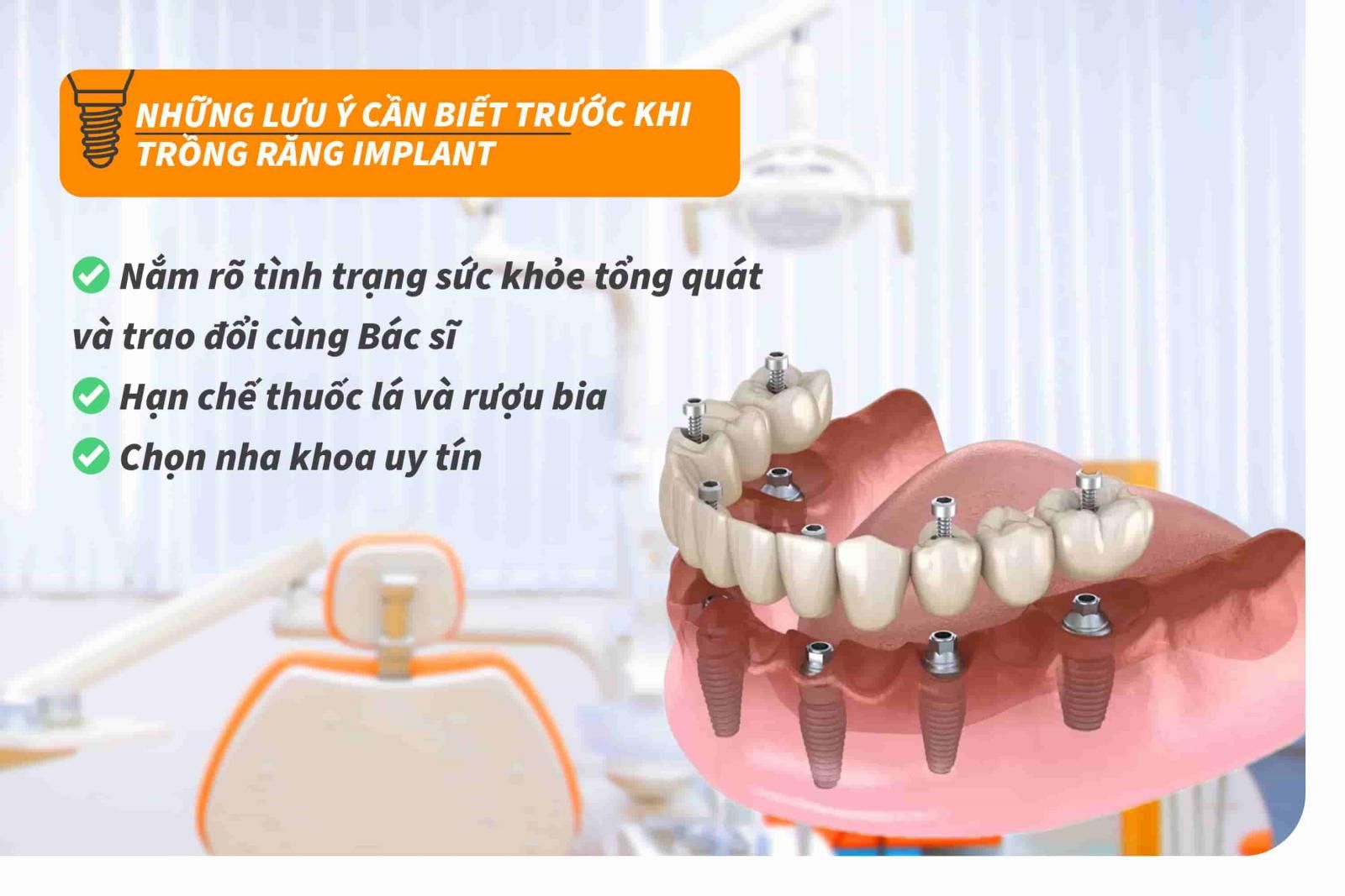 Những lưu ý cần biết trước khi trồng răng Implant