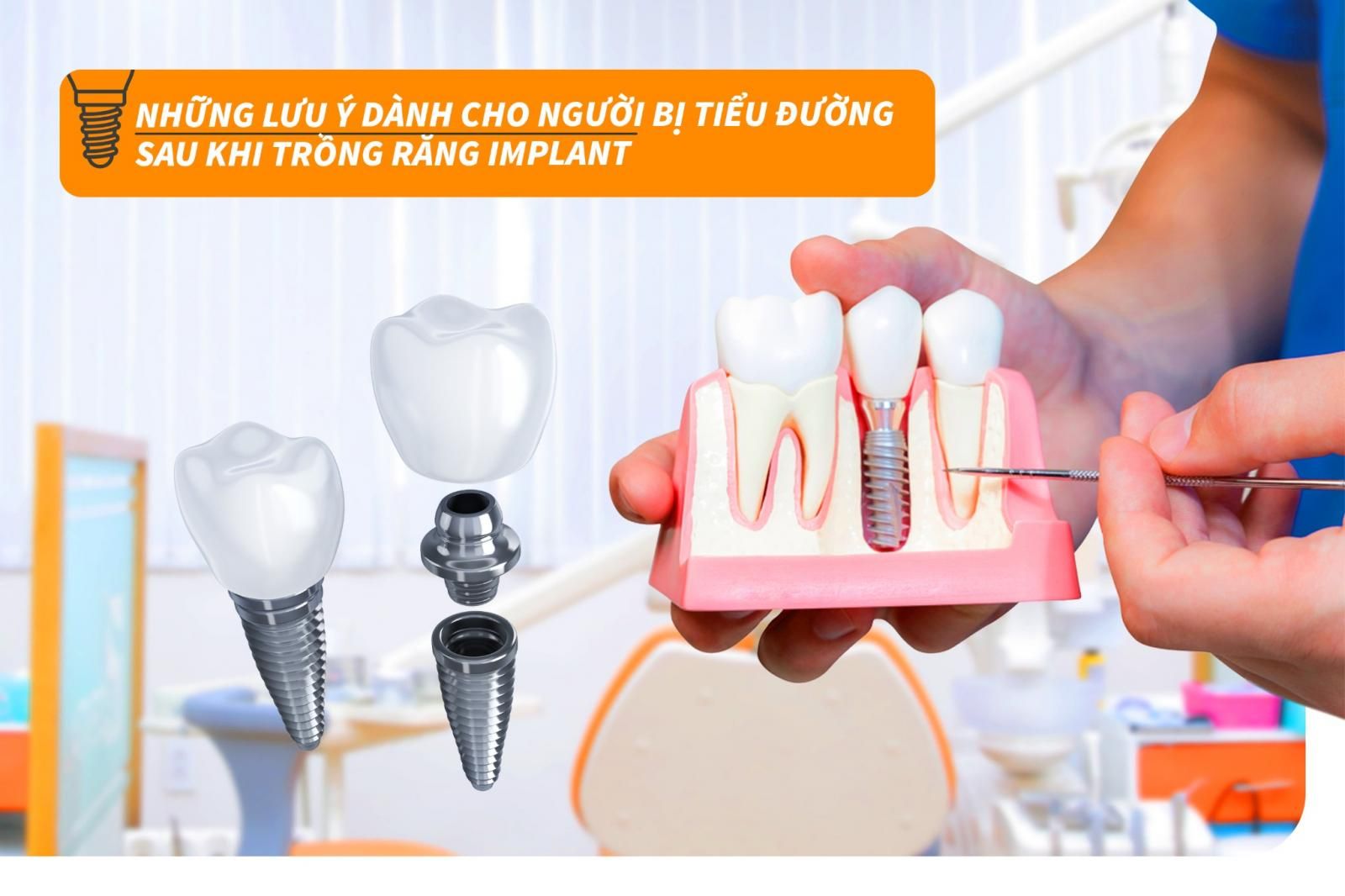 Người bị tiểu đường cần lưu ý gì sau khi trồng răng Implant?