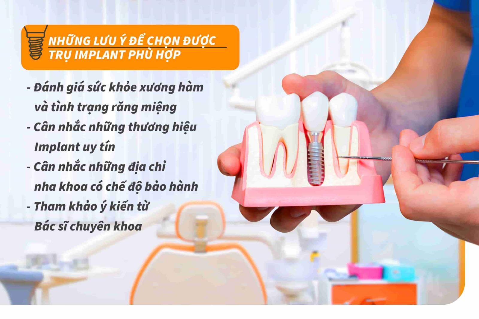 Những lưu ý để chọn trụ Implant phù hợp