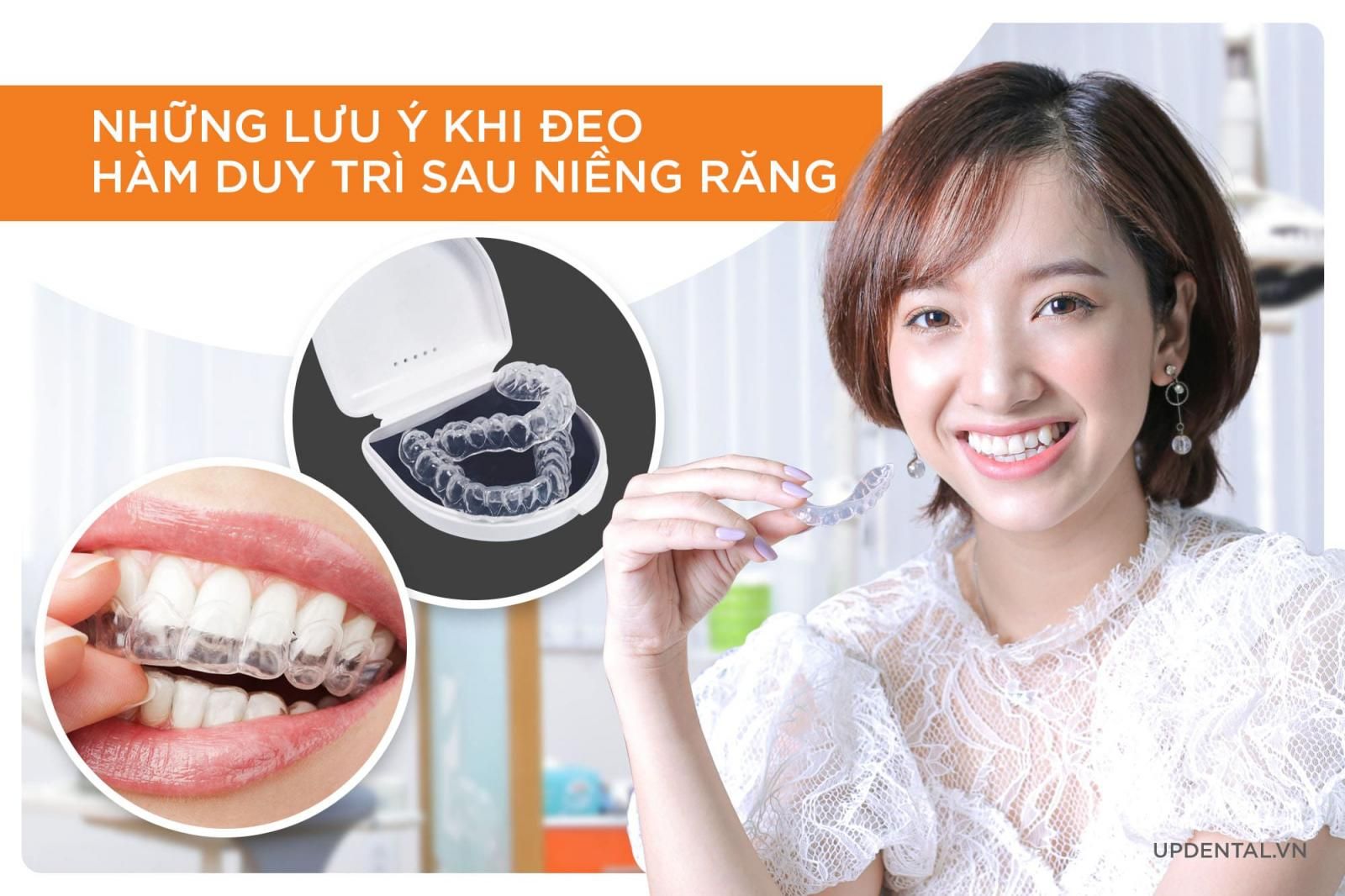 những lưu ý khi đeo hàm duy trì