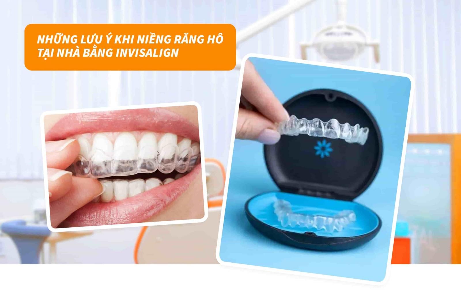 Những lưu ý khi niềng răng hô tại nhà bằng Invisalign