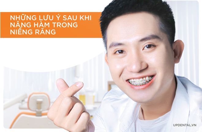 những lưu ý sau khi nâng hàm trong niềng răng