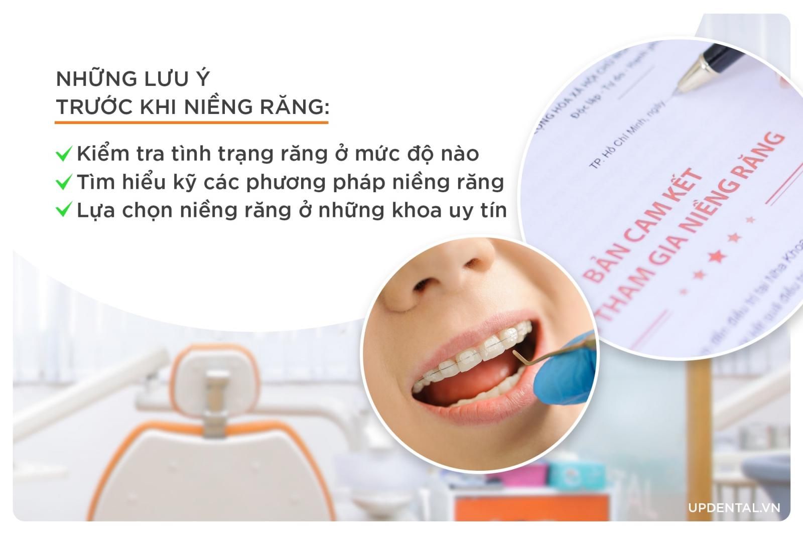 những lưu ý trước khi niềng răng