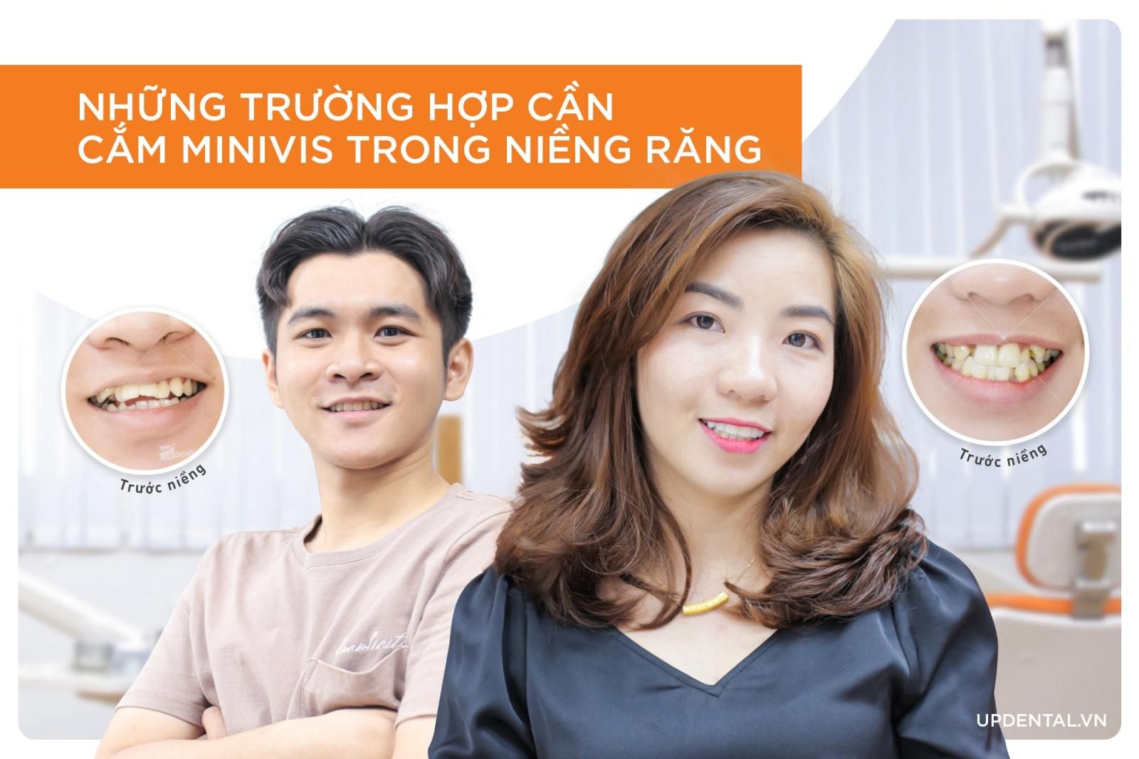 những trường hợp cần cắm minivis