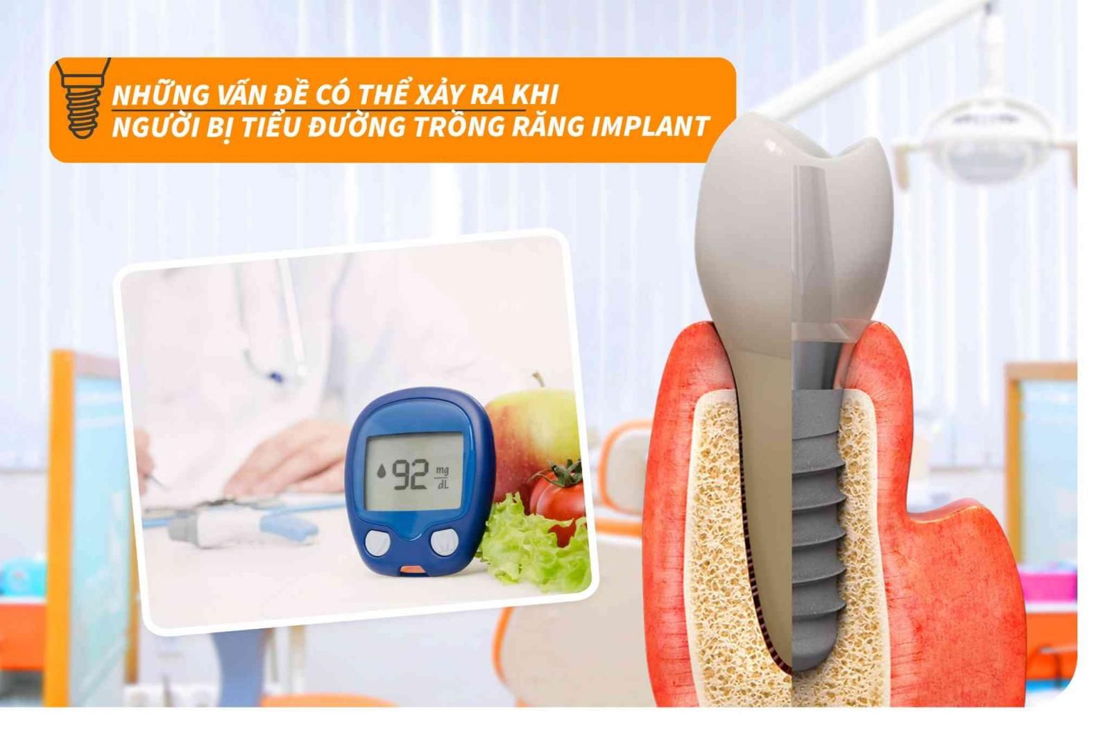 Những vấn đề có thể xảy ra khi người bị tiểu đường trồng răng Implant