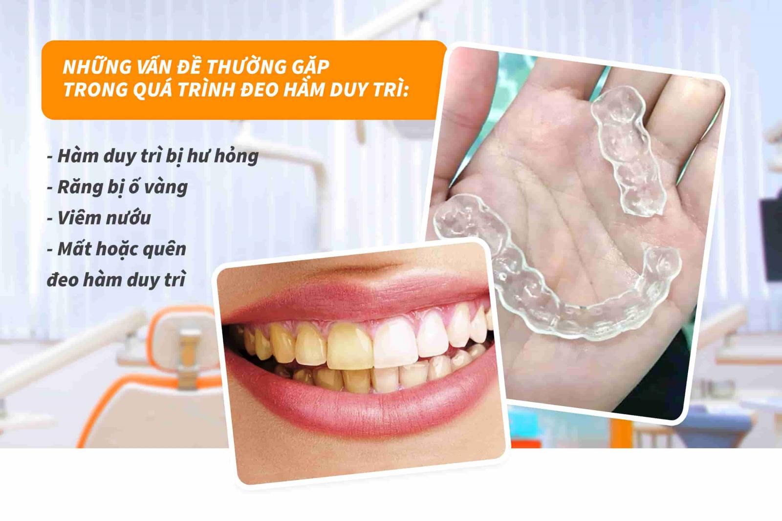 Những vấn đề thường gặp trong quá trình đeo hàm duy trì