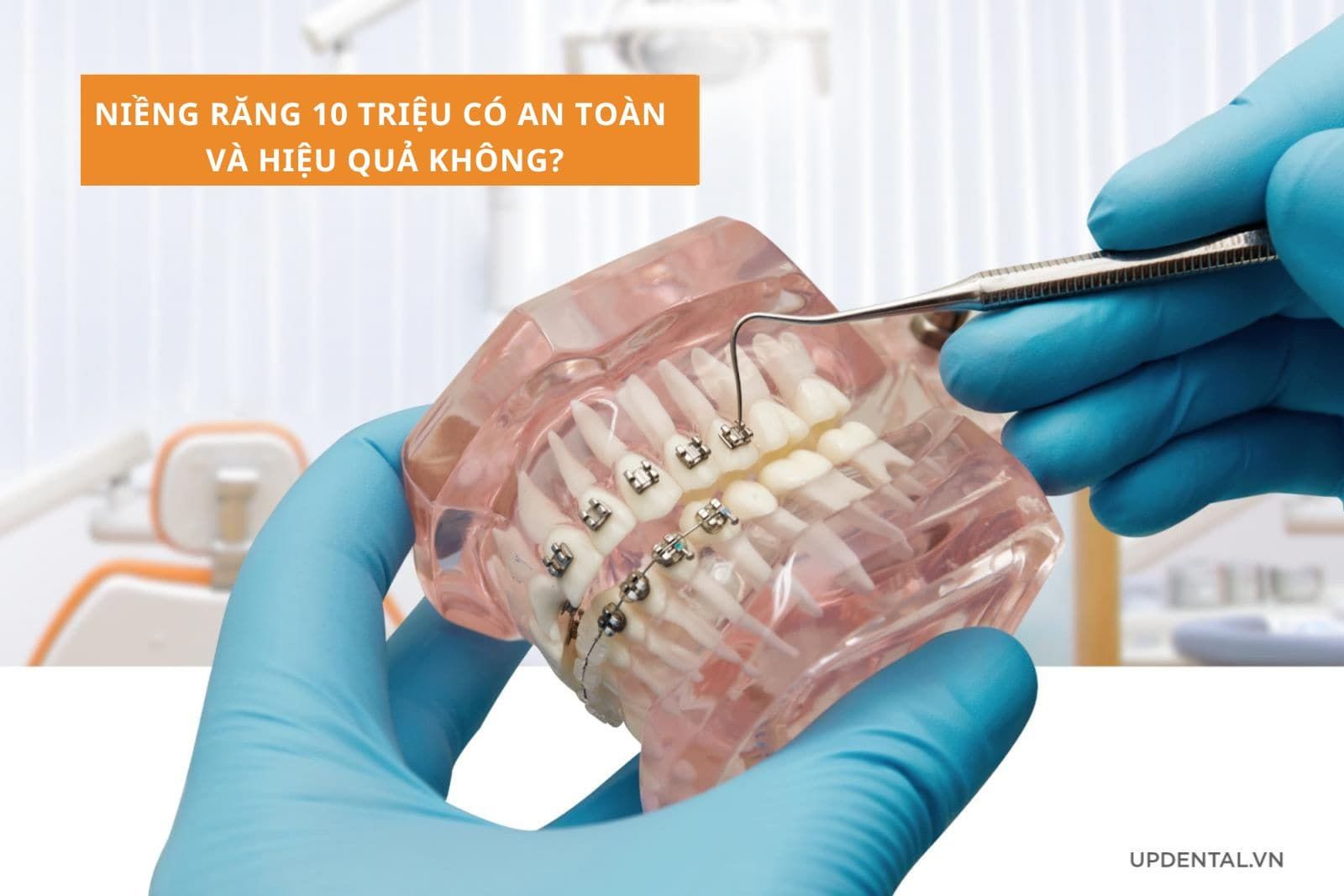 Niềng răng 10 triệu có an toàn và hiệu quả không?