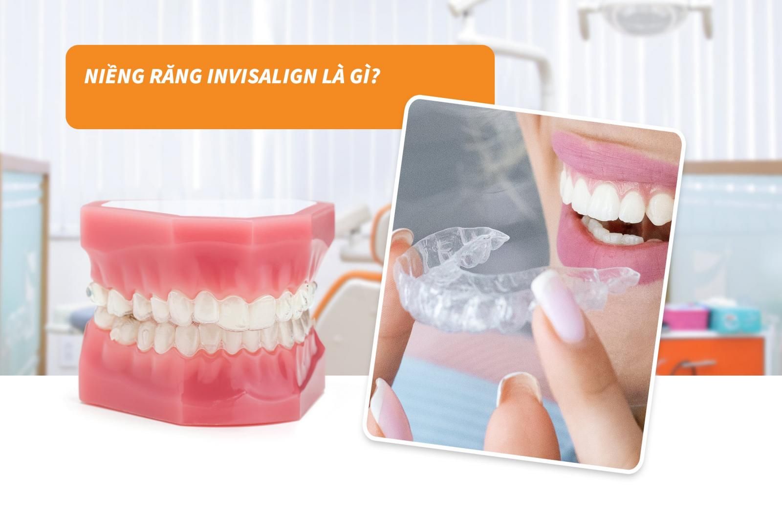 Hiểu hơn về niềng răng trong suốt Invisalign