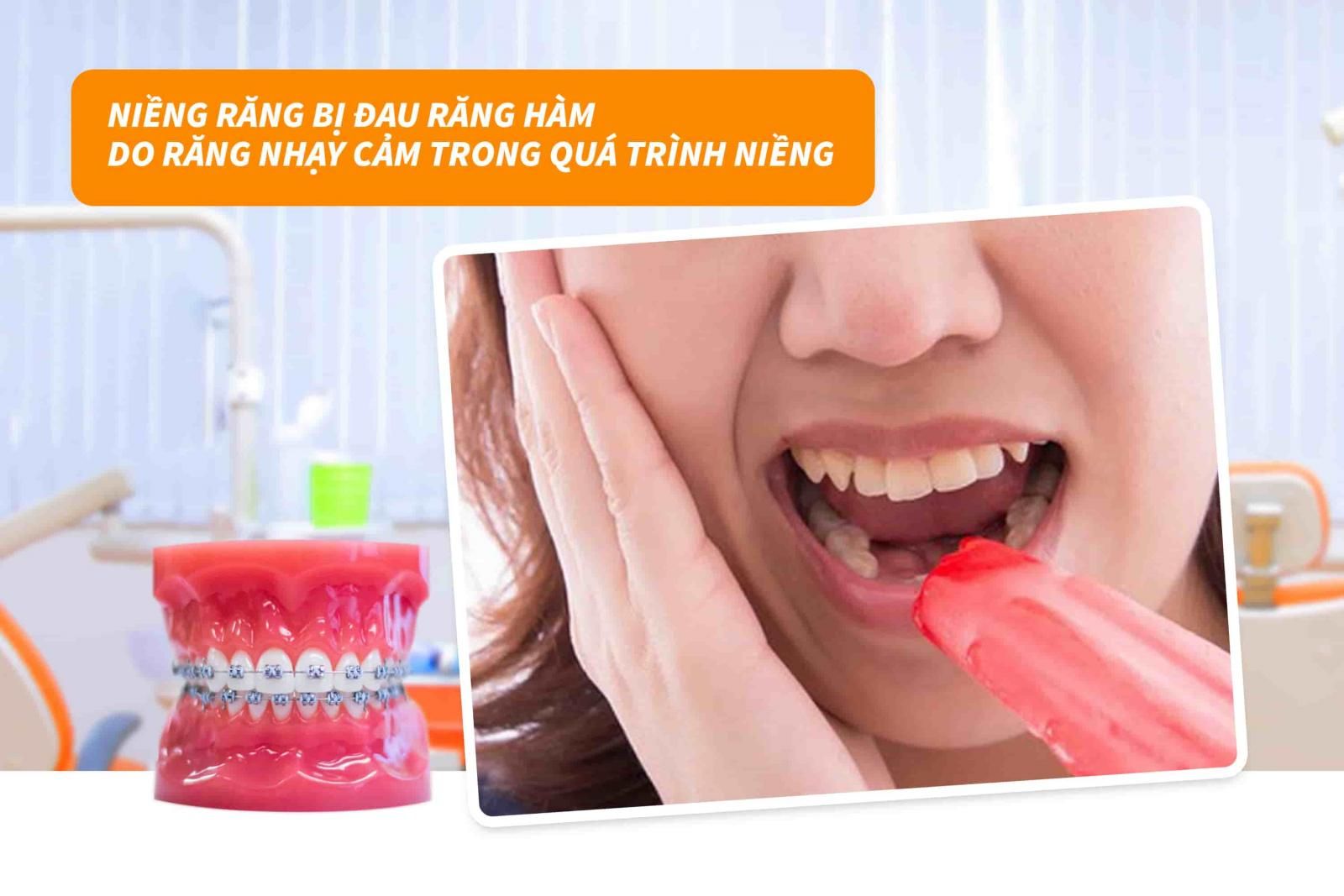 Tăng độ nhạy cảm của răng trong quá trình niềng 