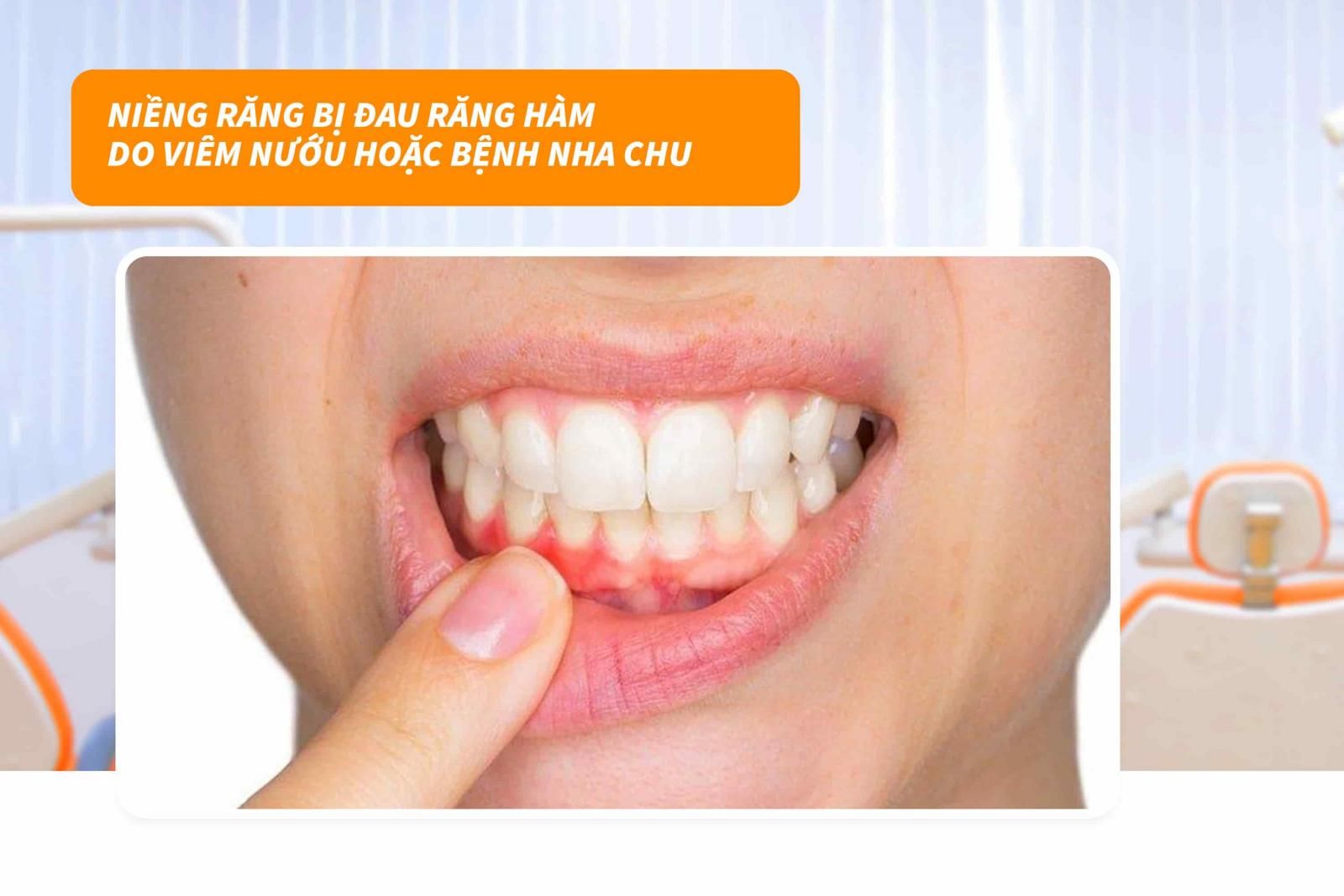 Viêm nướu hoặc bệnh nha chu