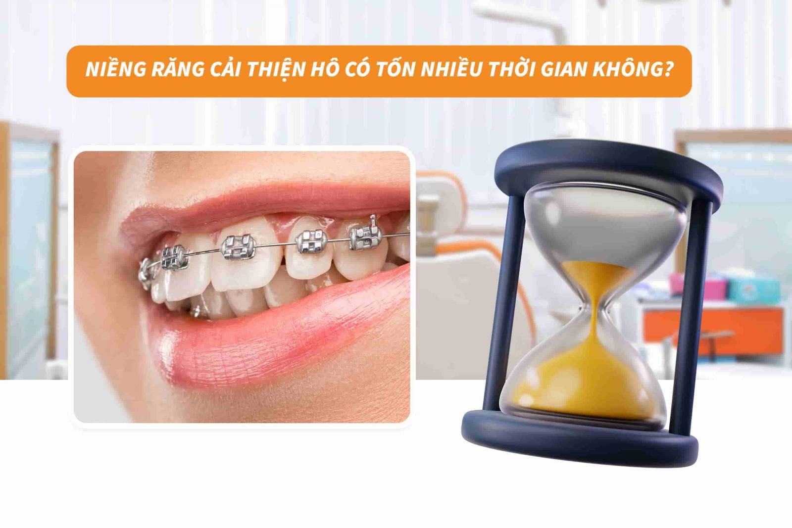 Niềng răng cải thiện hô có tốn thời gian không?