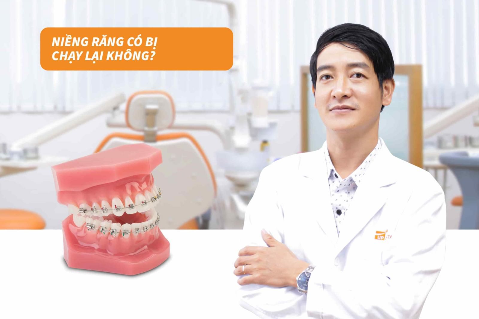 Niềng răng có bị chạy lại không? 