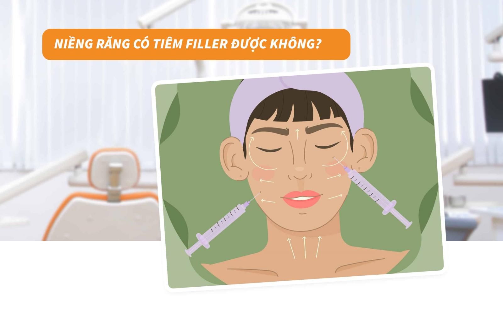 Niềng răng có tiêm filler được không? 