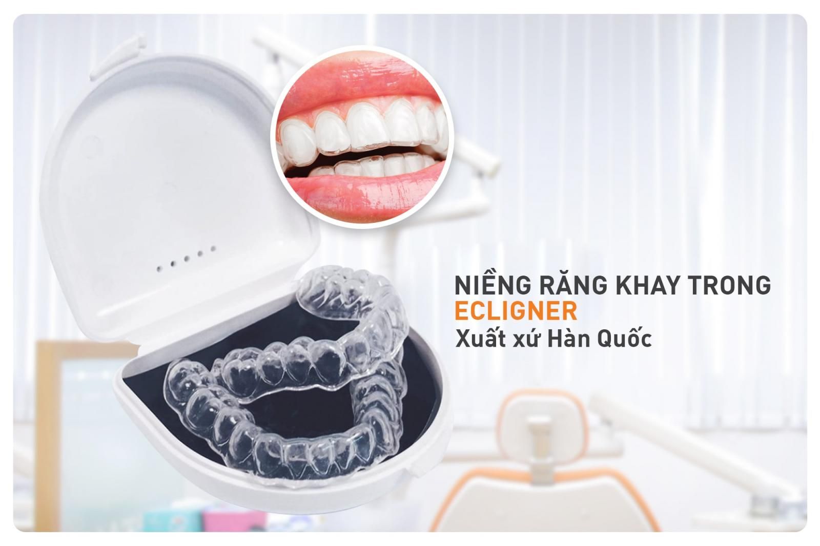 niềng răng khay trong ecligner là gì