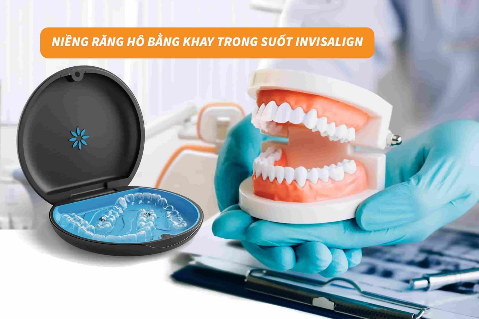 Niềng răng hô bằng khay trong suốt Invisalign