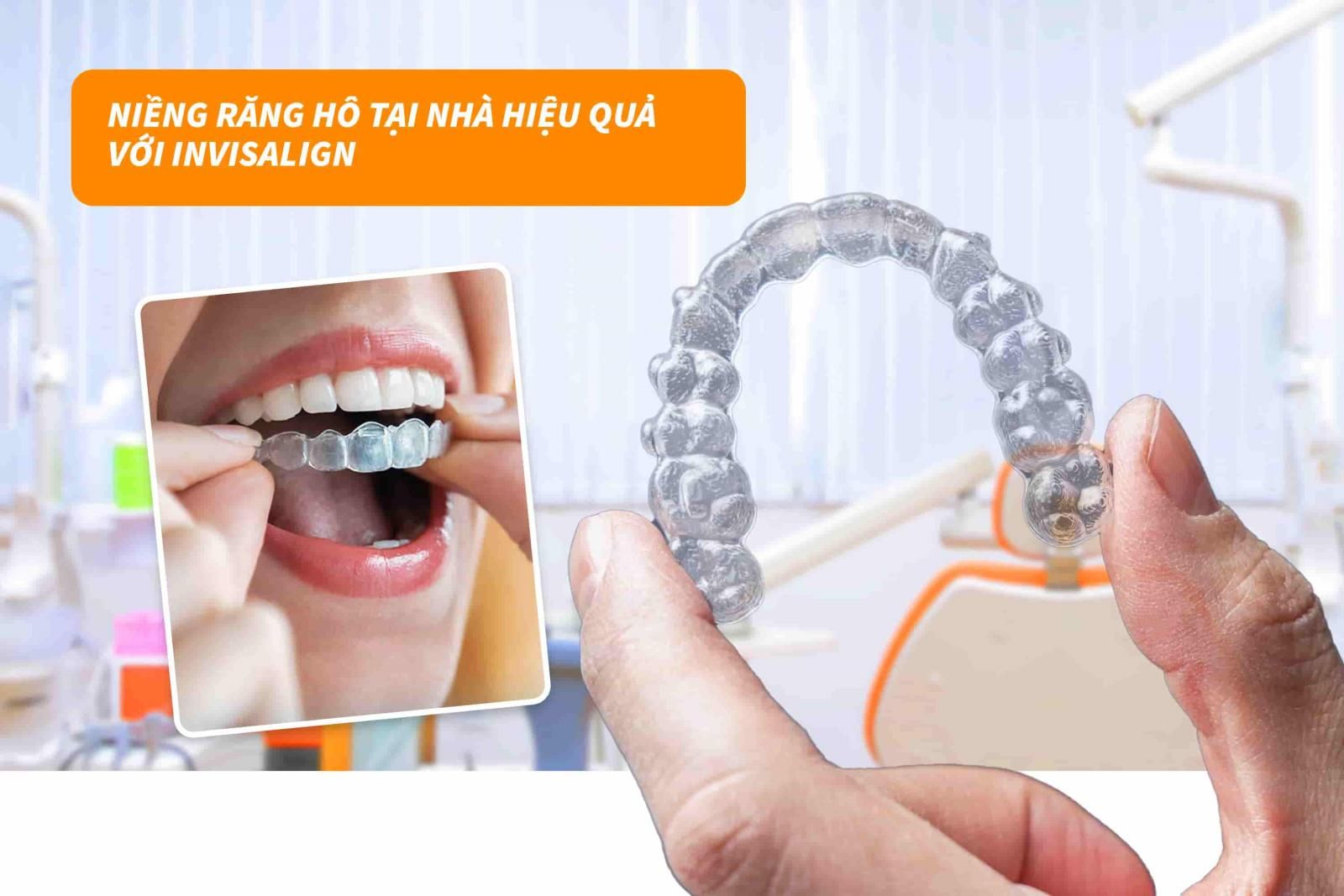 Niềng răng hô tại nhà hiệu quả với Invisalign