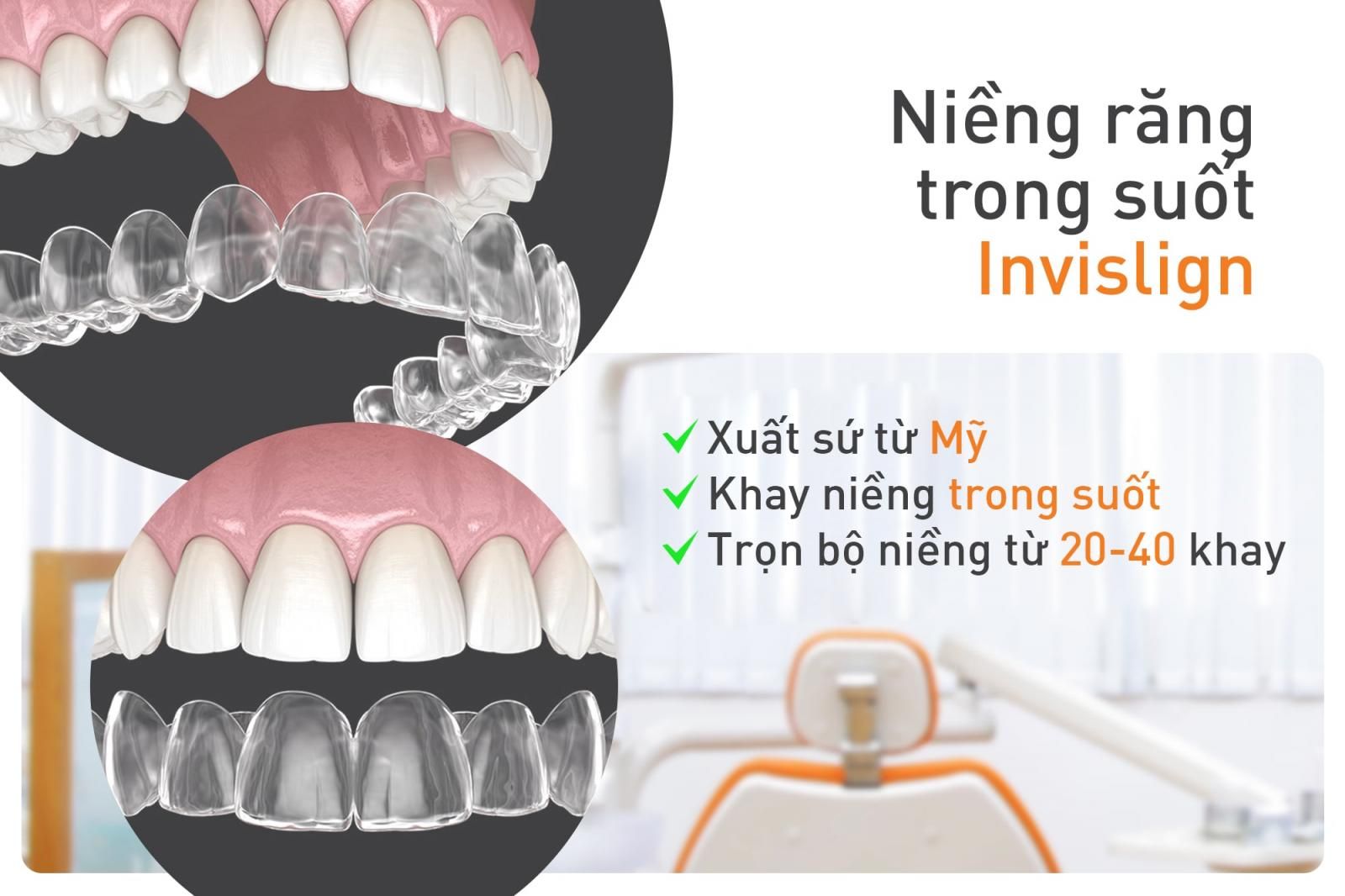 niềng răng trong suốt invisalign