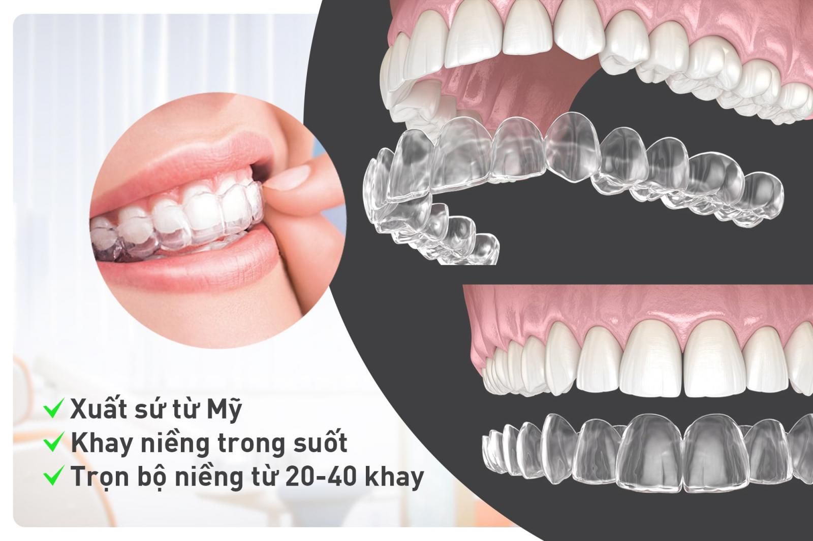 Niềng răng Invisalign - Phương pháp chỉnh nha hiện đại và thẩm mỹ