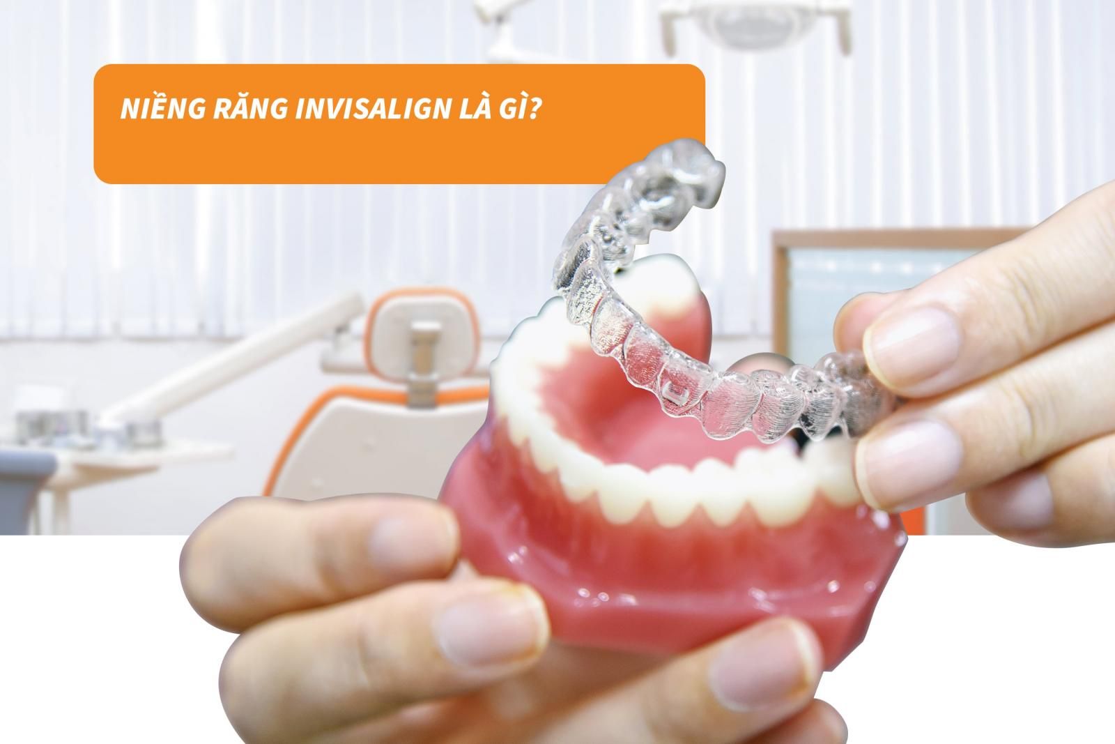 Niềng răng invisalign là gì?