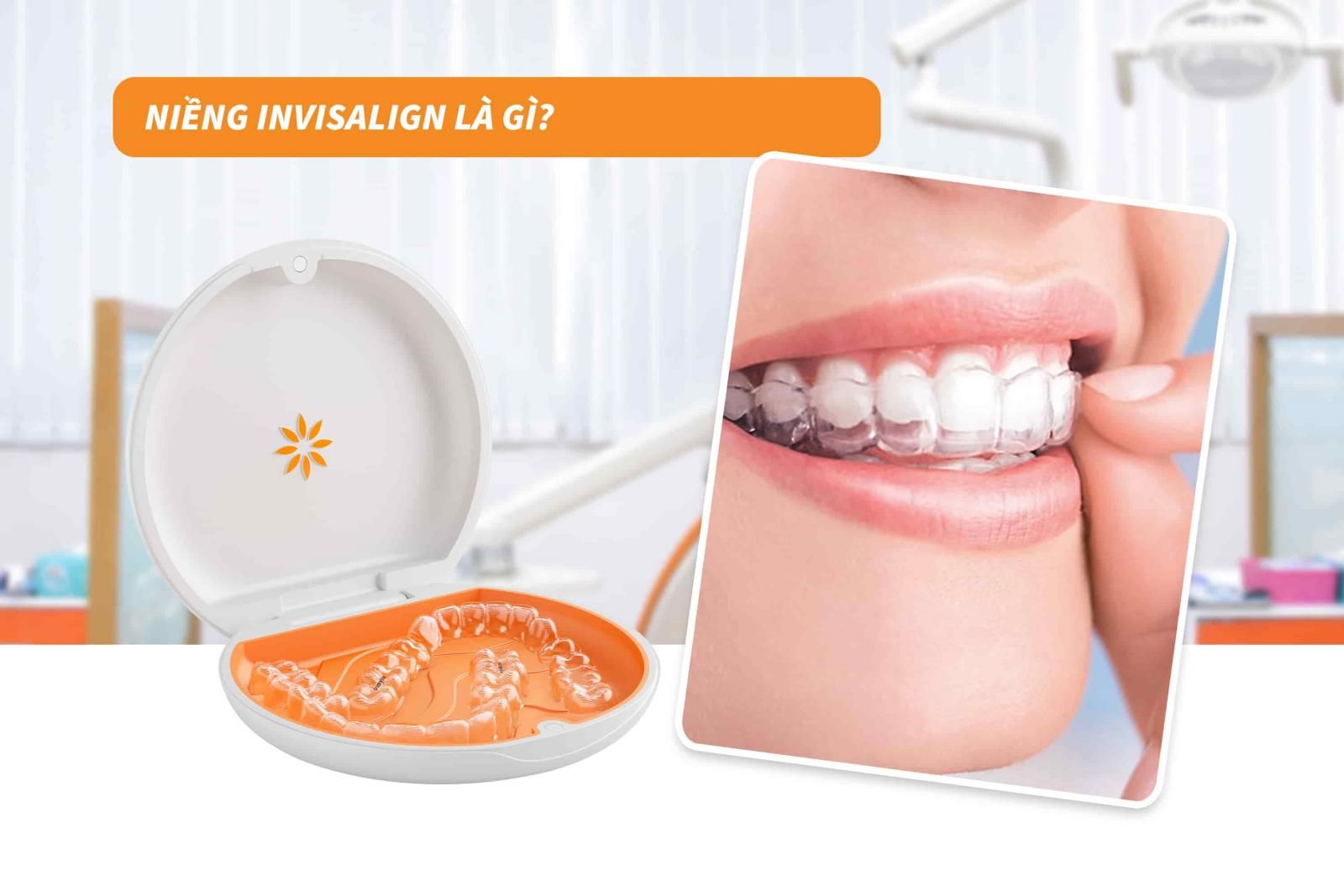 Niềng Invisalign là gì?