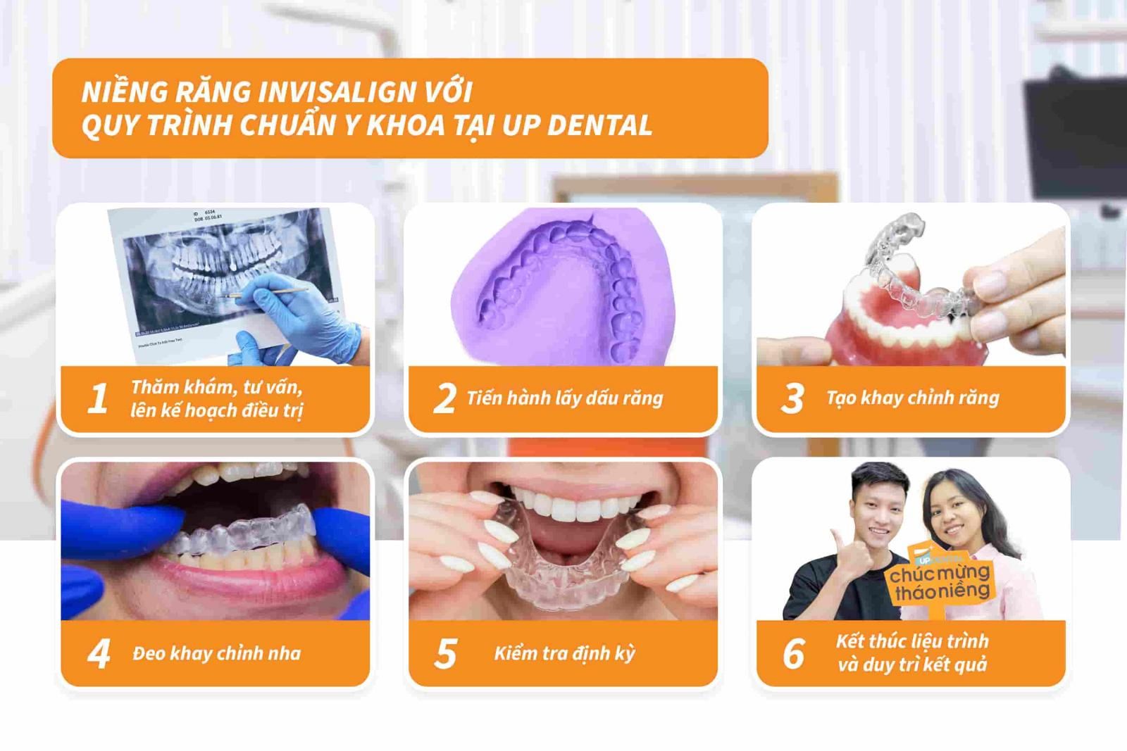 Niềng răng Invisalign với quy trình chuẩn Y khoa tại Up Dental