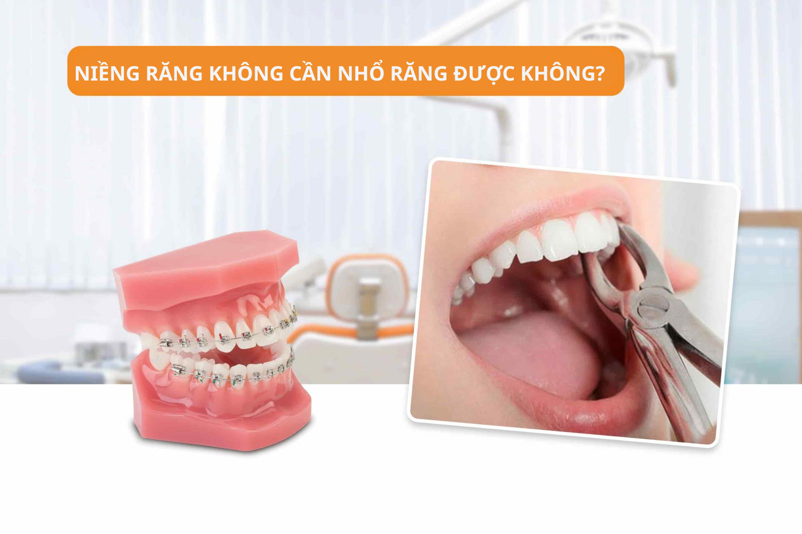 Niềng răng không cần nhổ răng có được không?