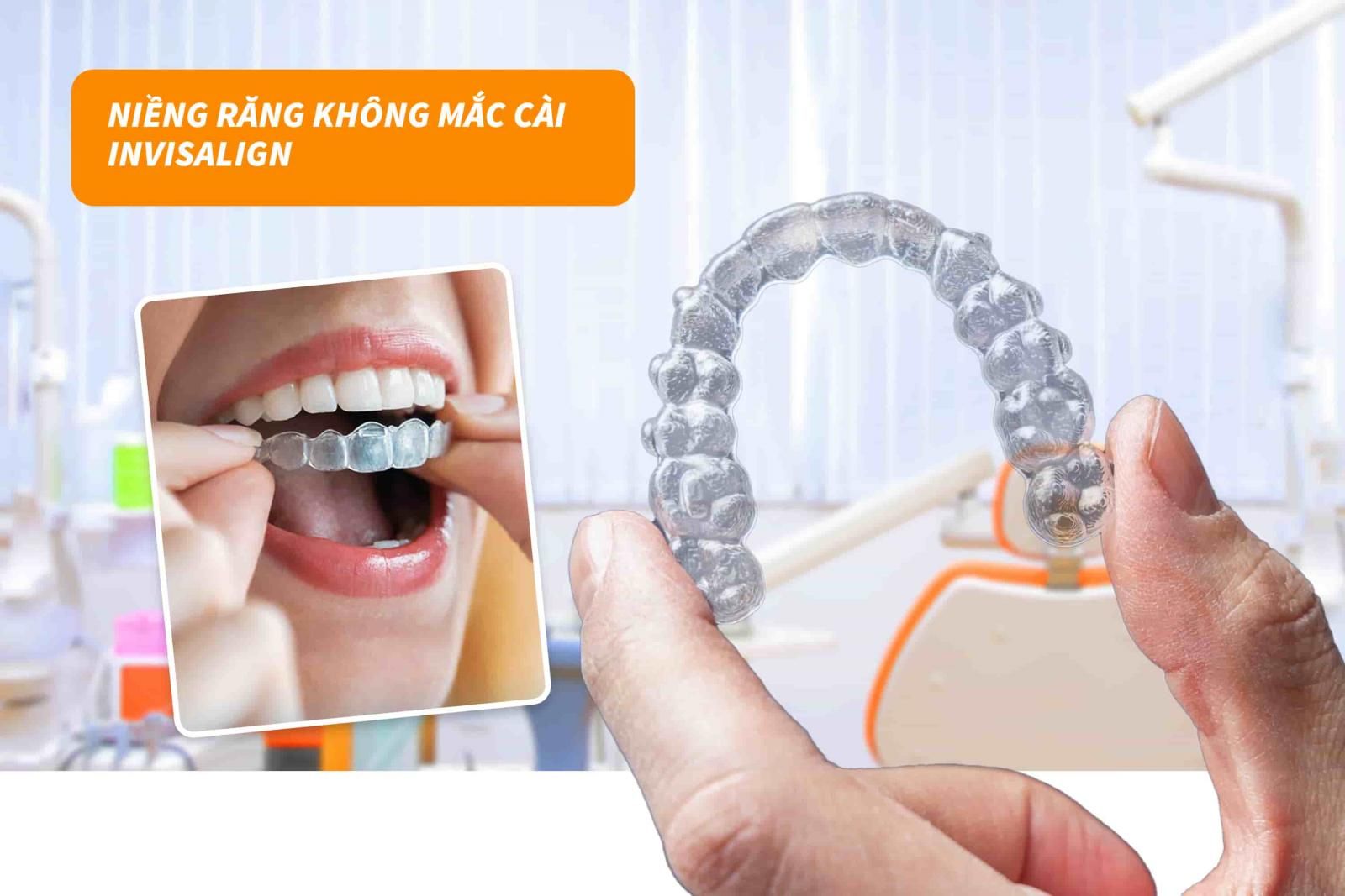 Niềng răng không mắc cài Invisalign 