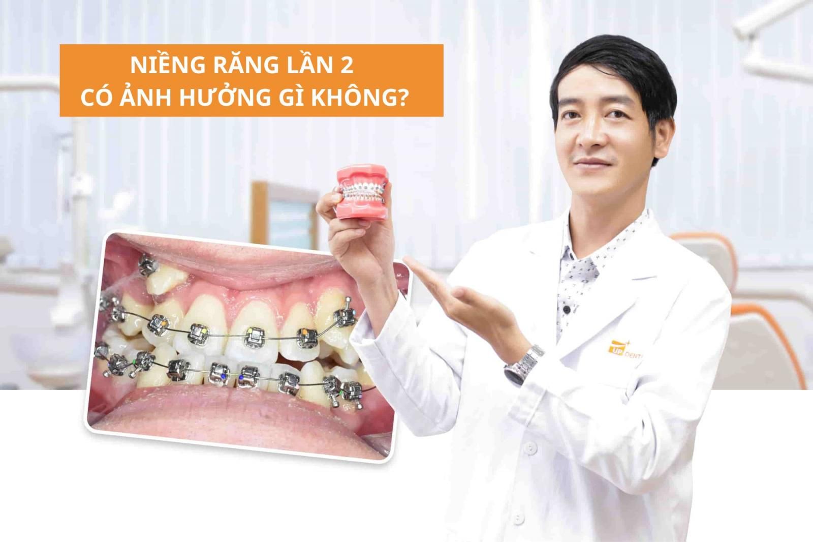 Niềng răng lần 2 có ảnh hưởng gì không?