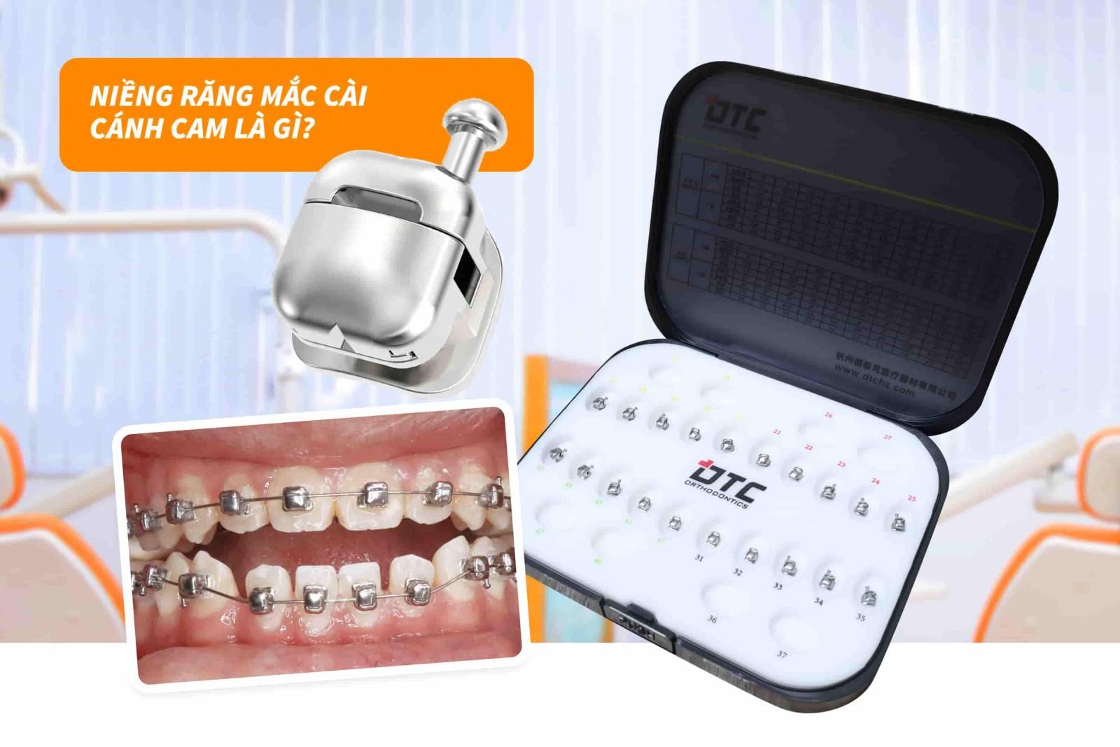 Niềng răng mắc cài cánh cam là gì