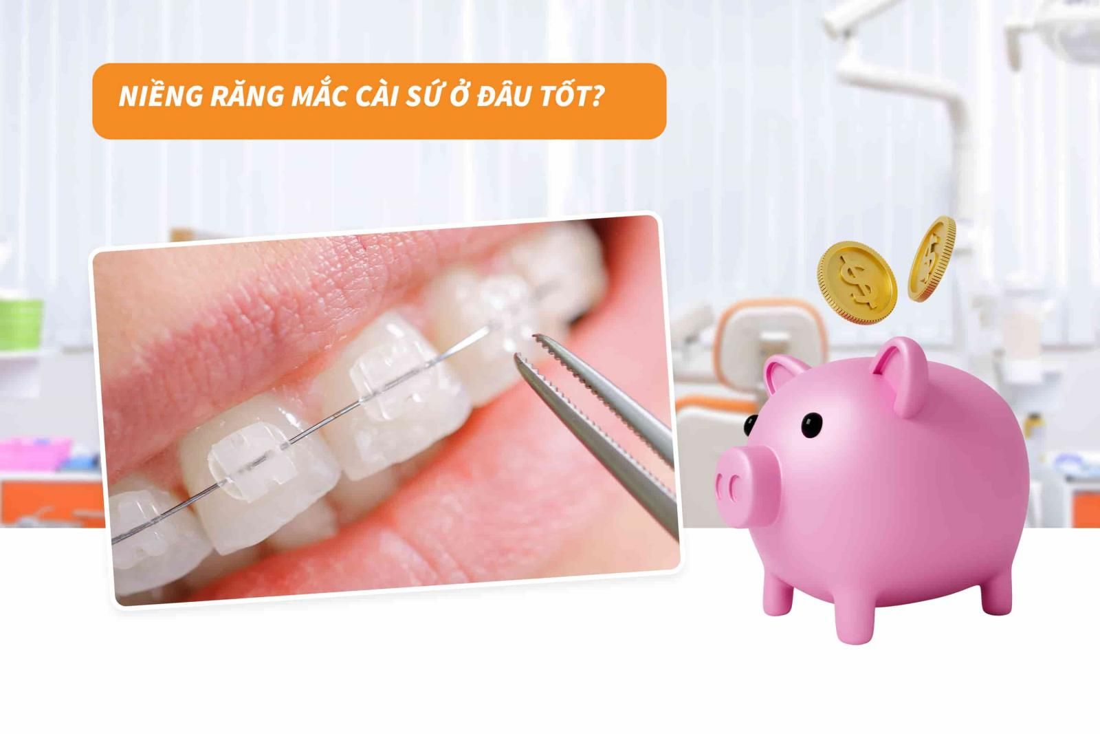 Niềng răng mắc cài sứ ở đâu tốt