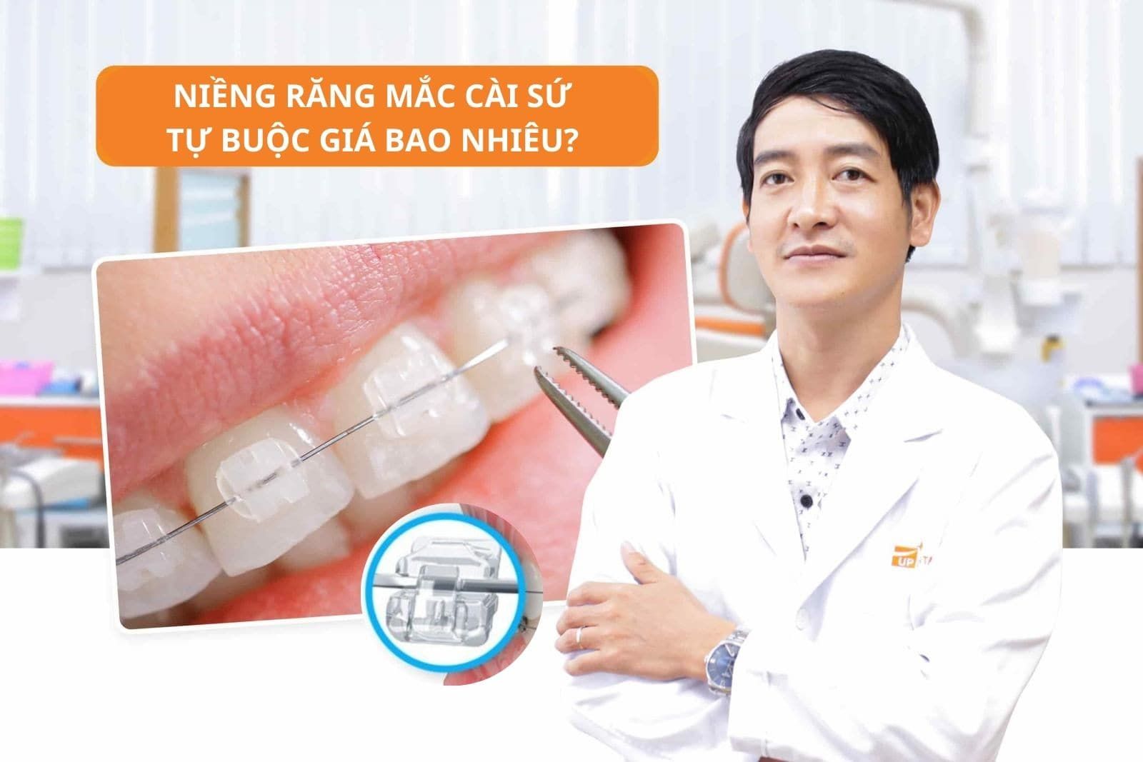 Niềng răng mắc cài sứ tự buộc giá bao nhiêu?