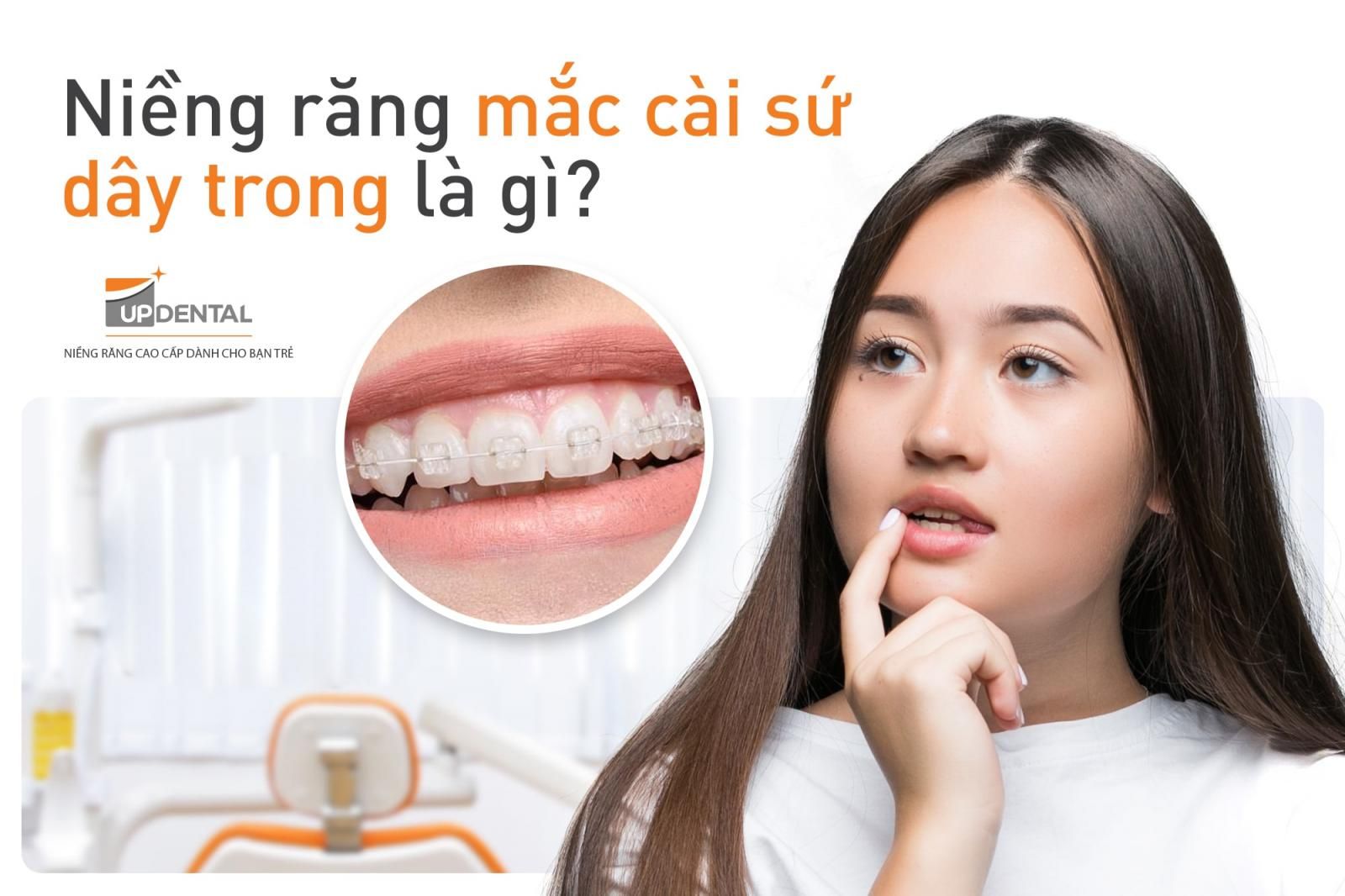 niềng răng mắc cài sứ dây trong