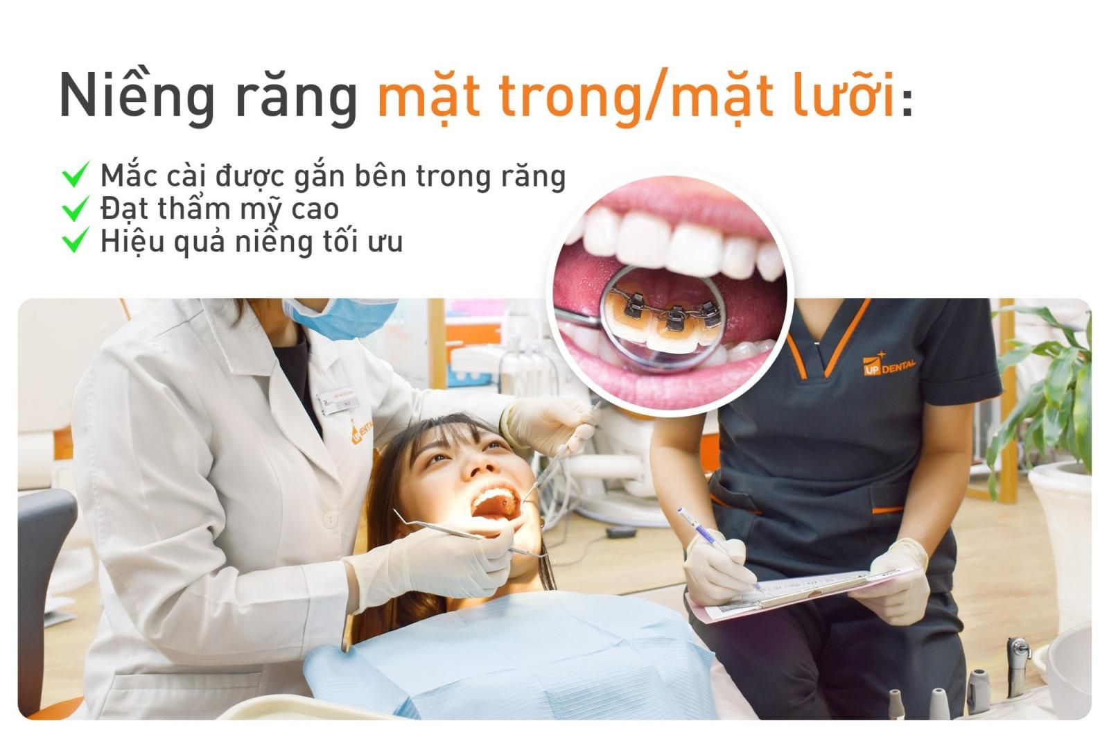 niềng răng mắc cài mặt trong