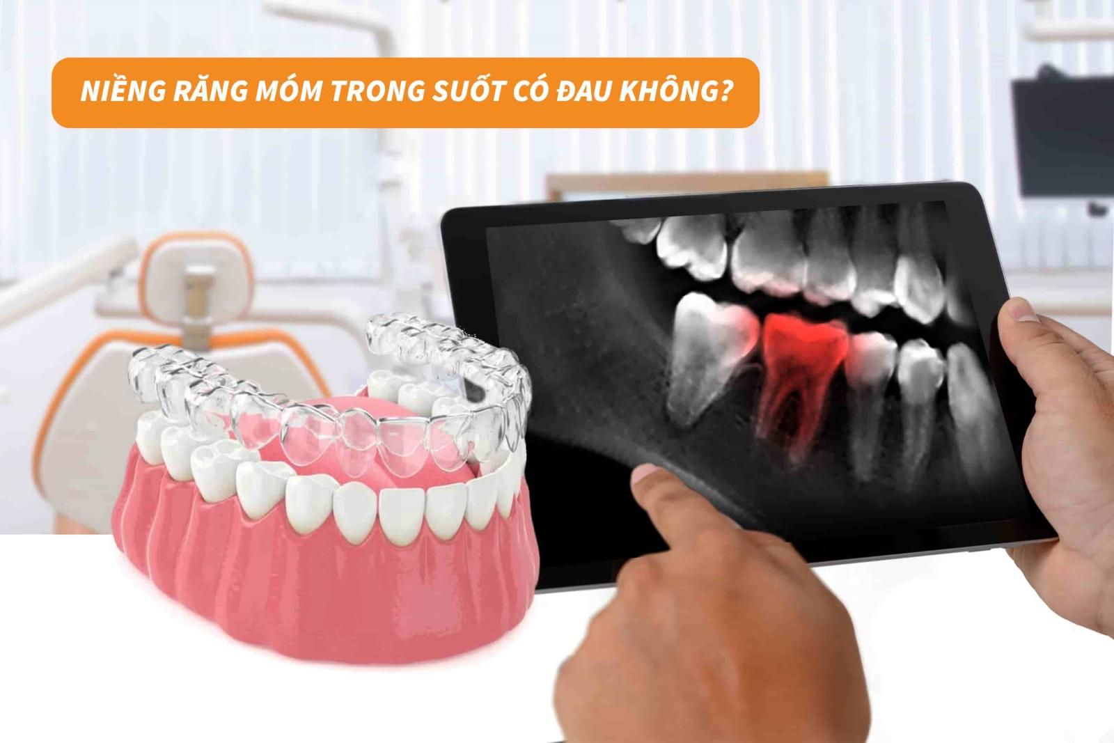 Niềng răng móm trong suốt có đau không?