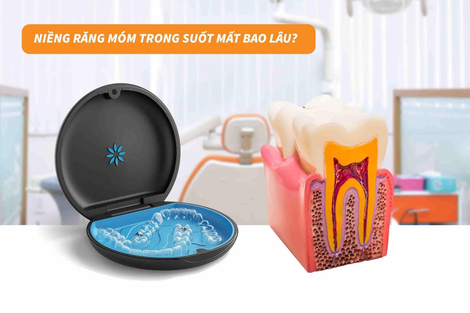 Niềng răng móm trong suốt mất bao lâu?