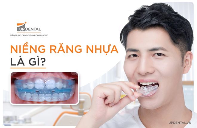 niềng răng nhựa là gì