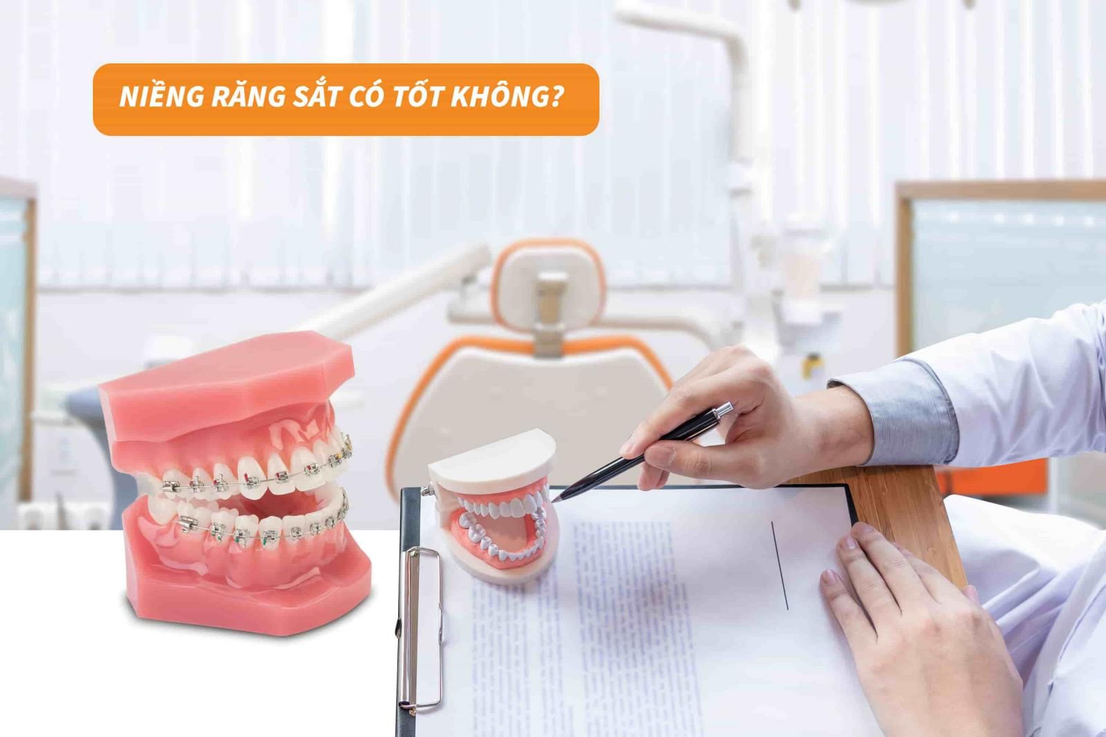 Niềng răng sắt có tốt không?